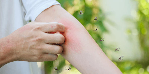little red dots on skin bug bites